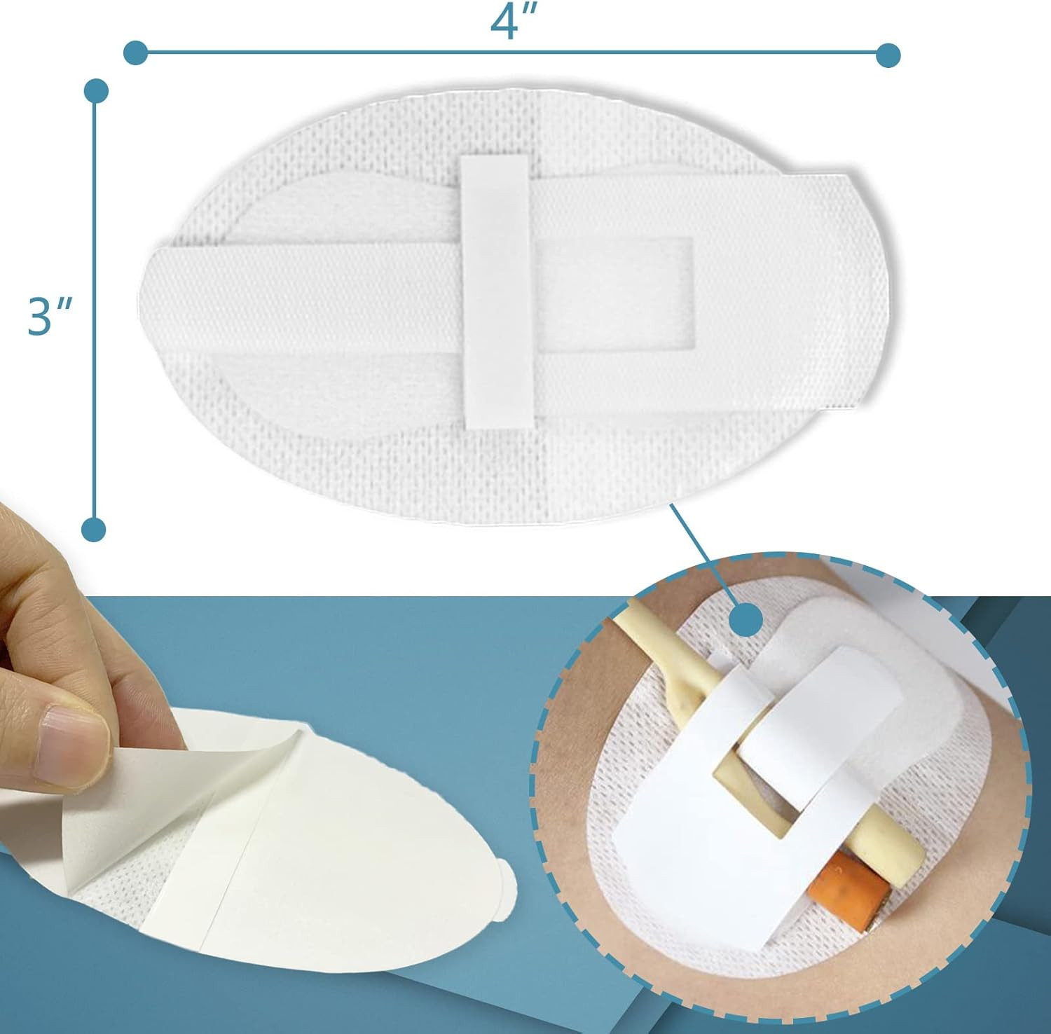 Urinary Tube Stabilization Fixation Stickers, Adhesive Pads for Leg Bag Support,