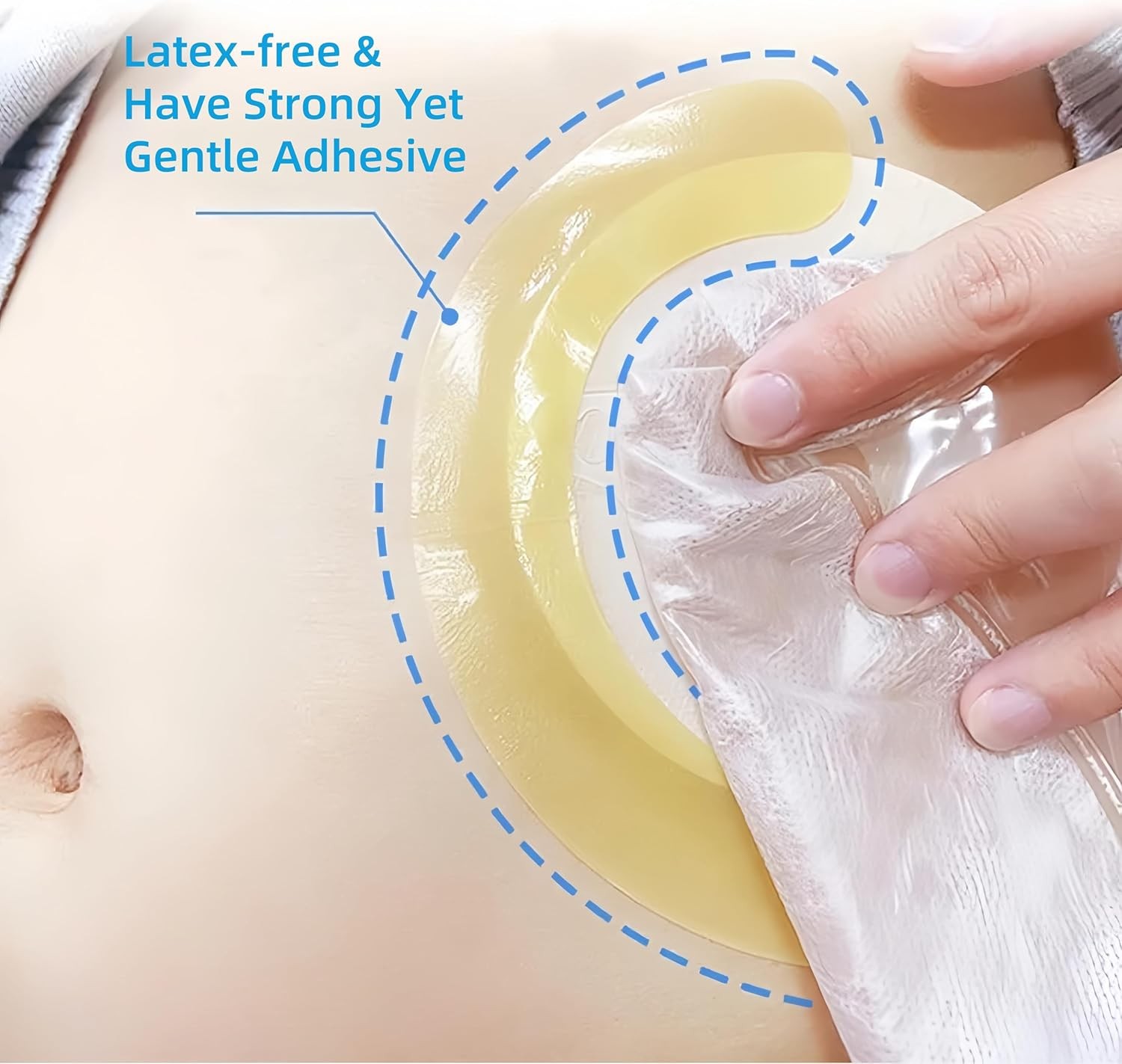 KONWEDA Ostomy Barrier Strips Elastic Barrier For Colostomy Bags Pack Of 10 …