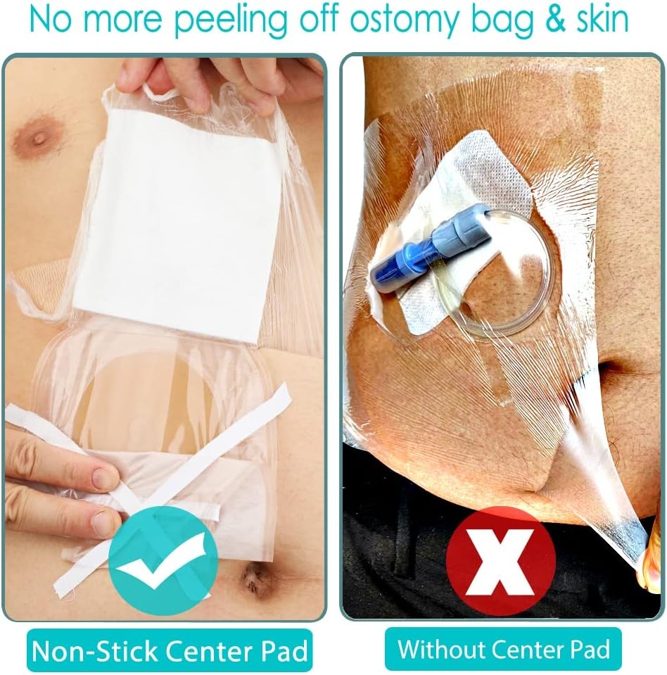 Waterproof Ostomy Bag Shower Cover with Non Cover(9×9, Pack of 25)