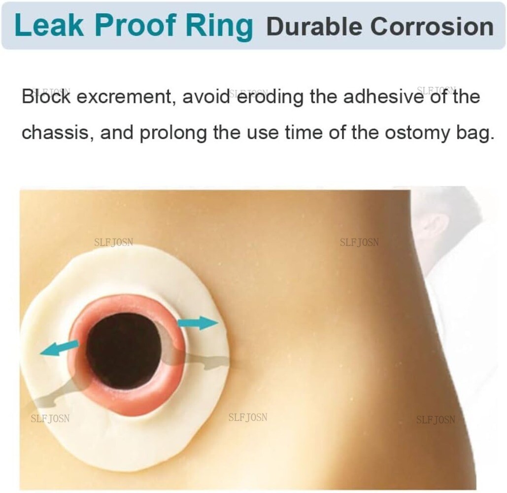 10/20Pack Ostomy Barrier Rings No Leaking Barrier Extenders for Colostomy Bags