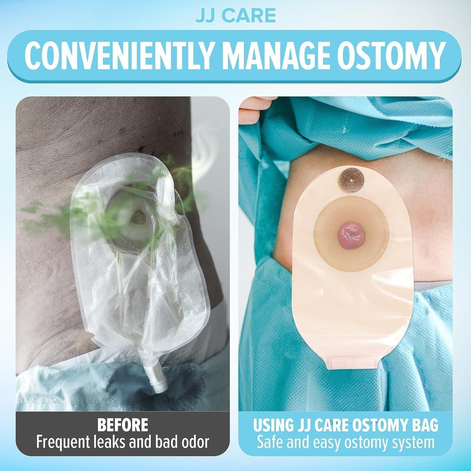 Colostomy Bags 20 PCS, One-Piece Pouching Ostomy Bags, No Mess Ostomy Supplies f