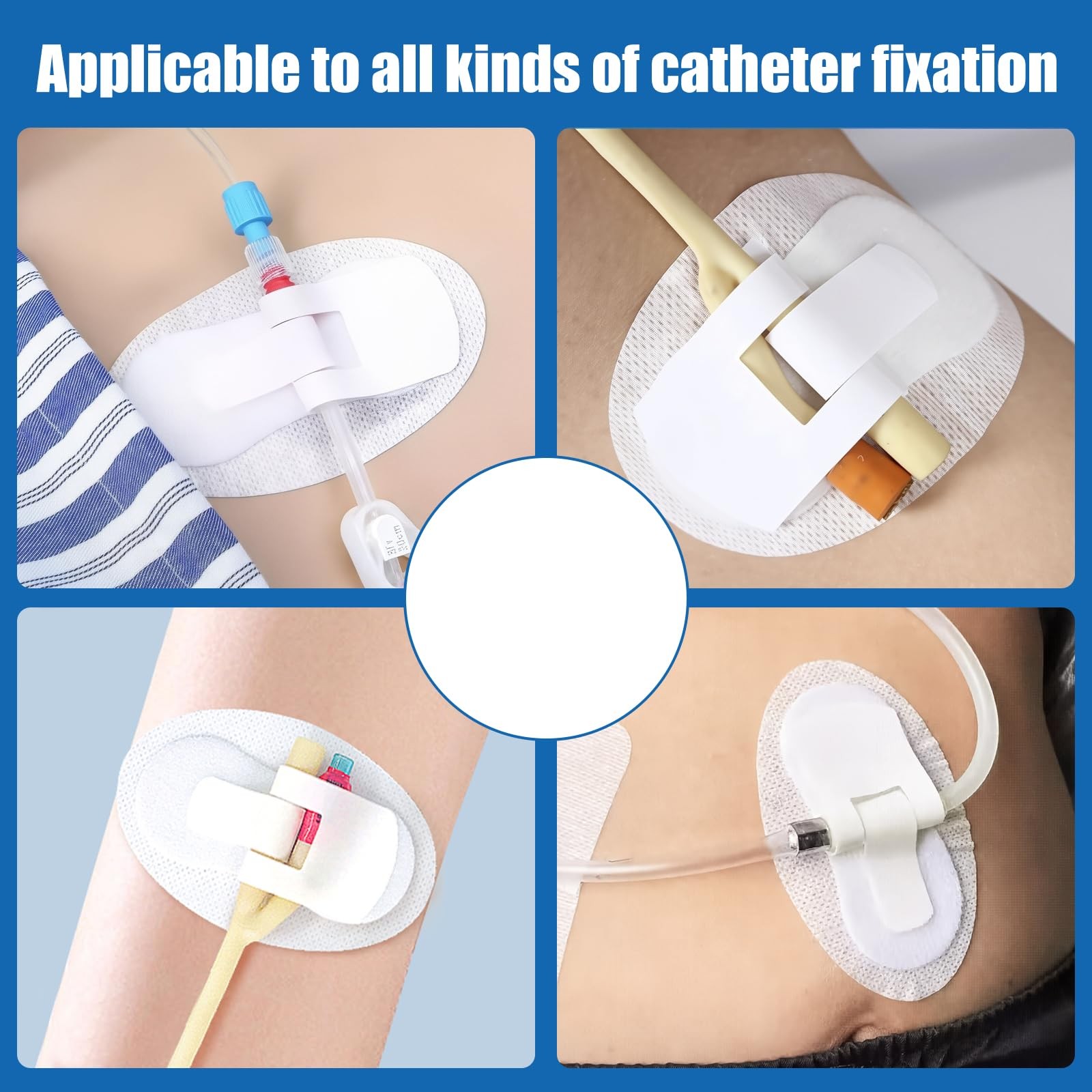 Catheter Stabilization Devices – 8 PCS Self-High Adhesive Catheter Holder, Ca…