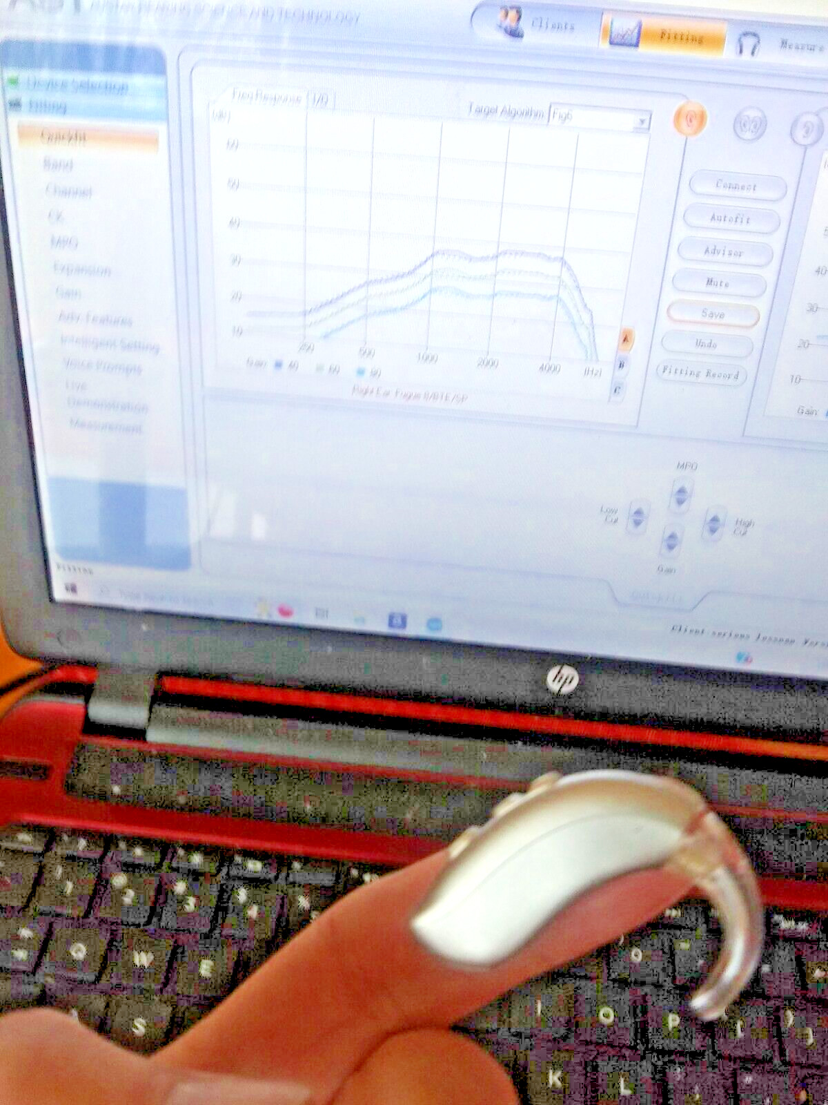 TWO PROGRAMMABLE BEHIND THE EAR DIGITAL HEARING AID PROFOUND hearing loss