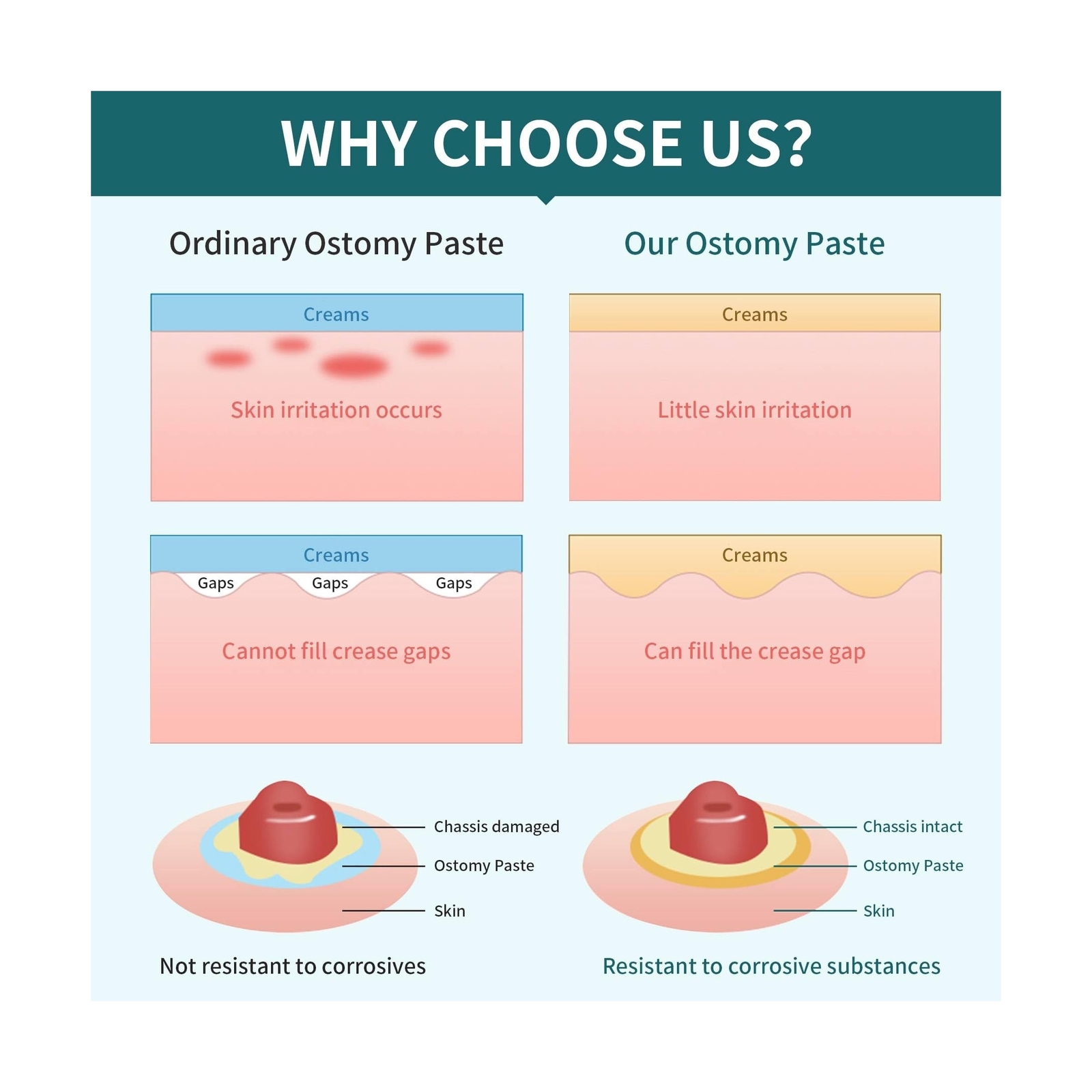 ostomy Filler Paste 2 oz. Tube (1 Tube)