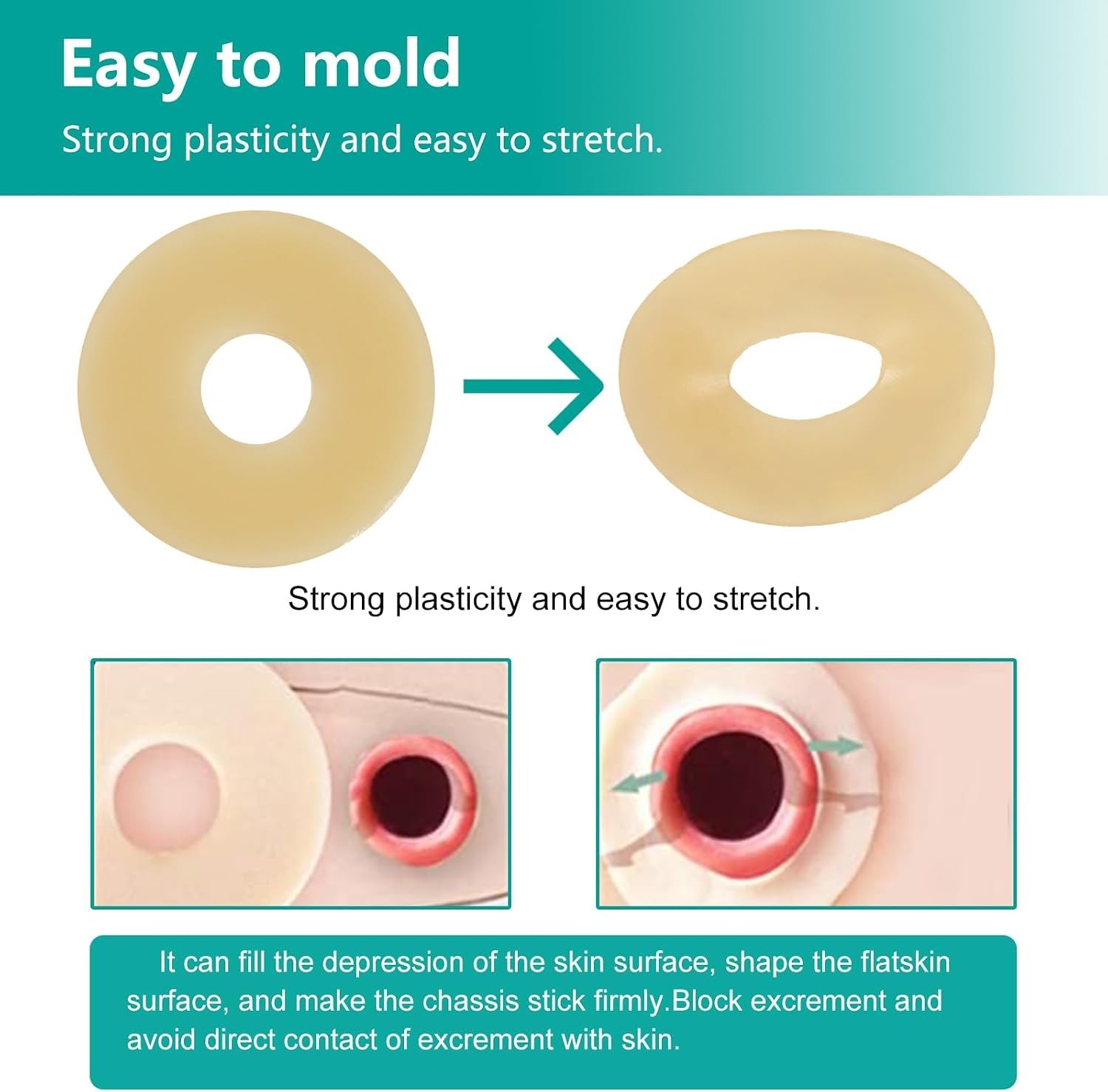 10 PCS Ostomy Barrier Rings, Ostomy Supplies, 2 Mm Thickness Moldable Ostomy Rin