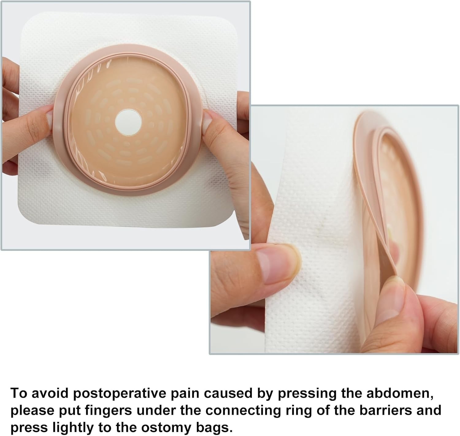 Ostomy Supplies Kit, Colostomy Bags with Carbon Filter