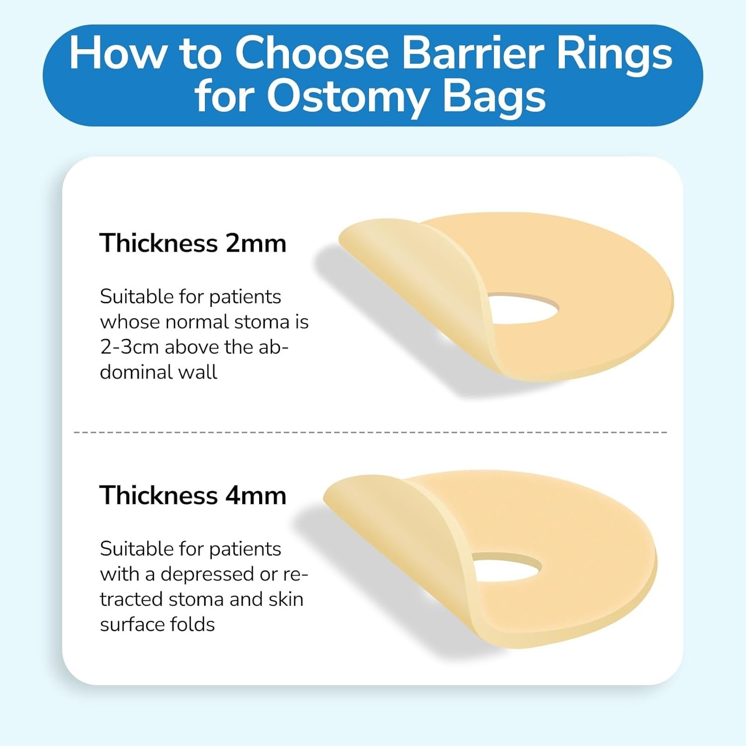 30 PCS Protective Ostomy Seal Rings 2mm – Moldable Hydrocolloid Barrier Seals