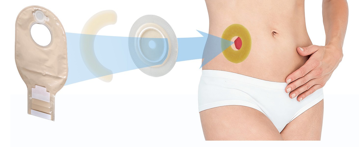 Ostomy Barrier Strips 50PCS Hydrocolloid Leak-Proof Stoma Tape Skin-Friendly