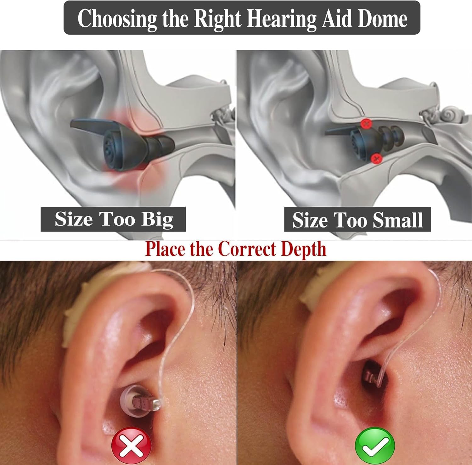6Packs-Starkey Hearing Aid Domes Open Oticon Hearing Aid Domes Small Medium Larg