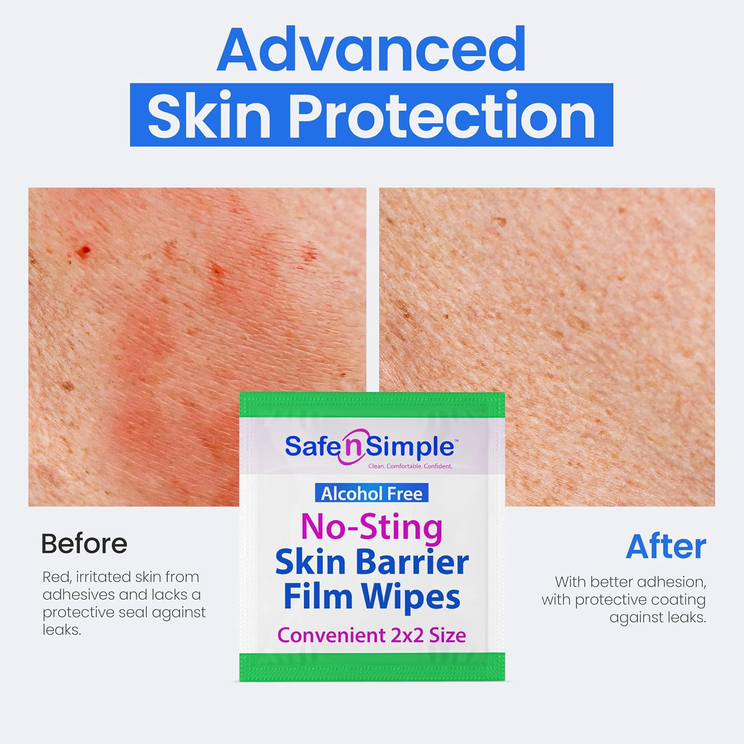 Safe n’ Simple Skin Barrier Wipes No-Sting – 2″ x 2″ – 100 Count – Alcohol-Free