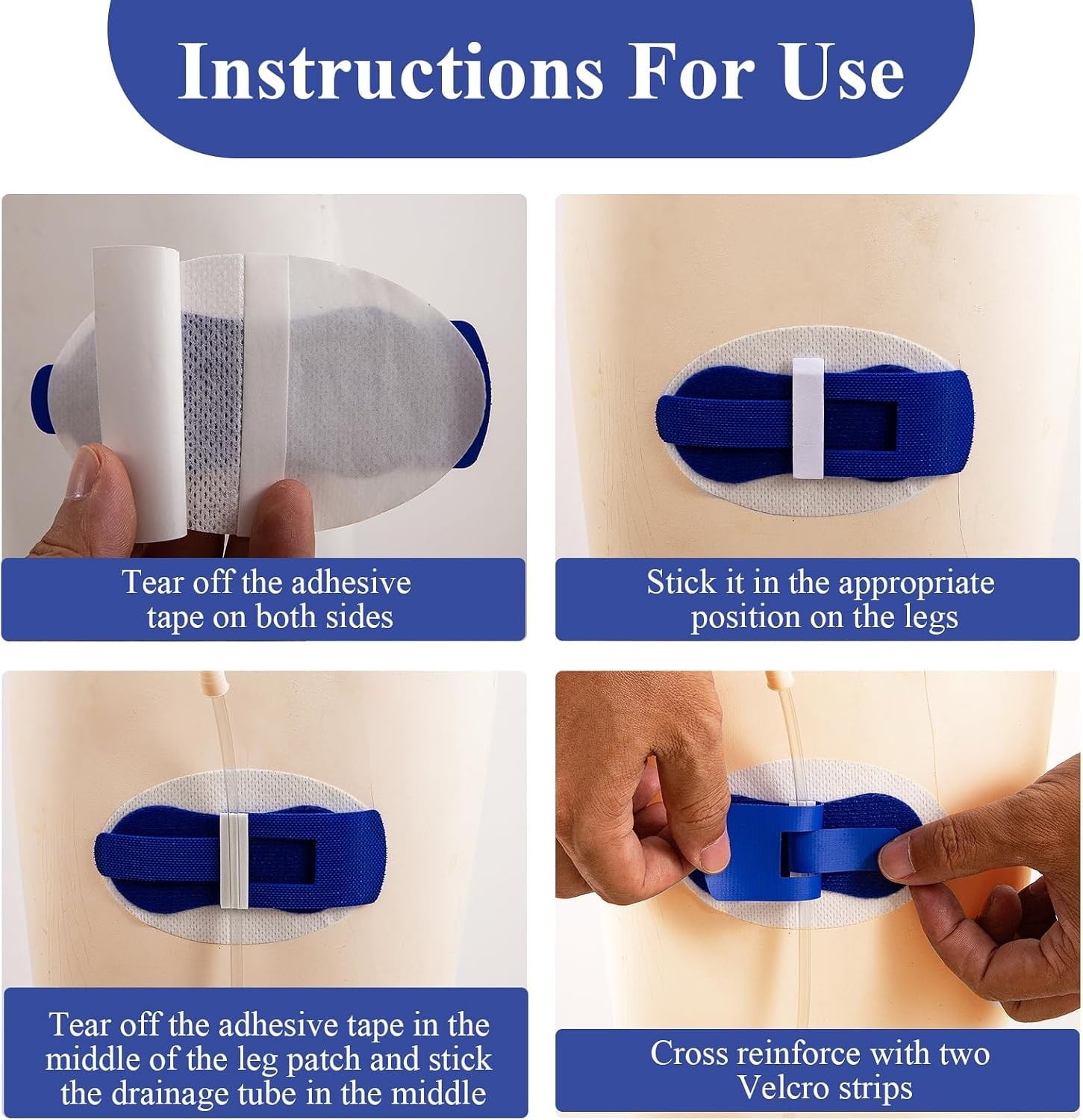 Foley Catheter Stabilization Device – 50 Pack Catheter Tube Holder Leg Sticke…
