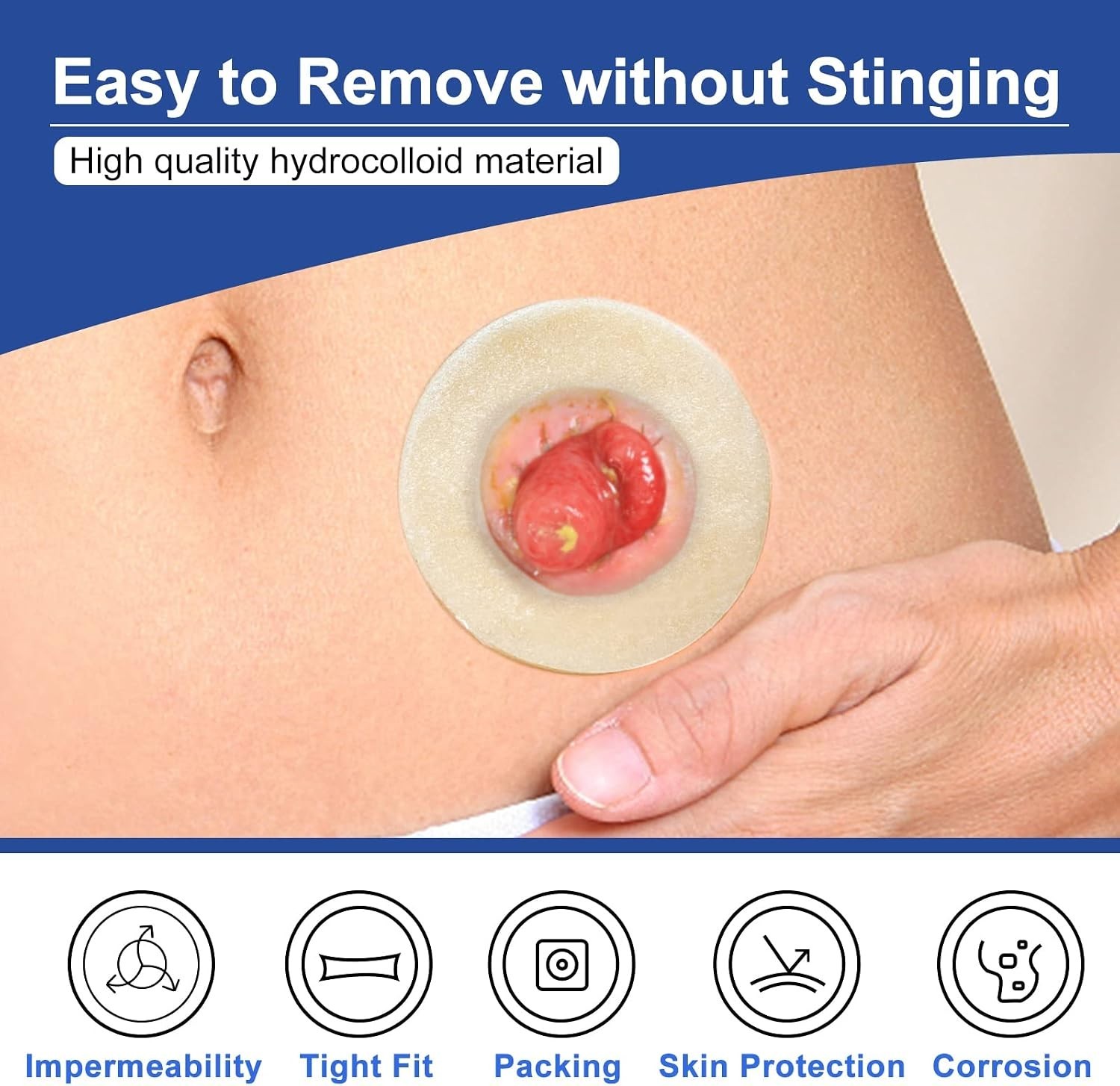 Carbou Ostomy Barrier Rings-Outer Diameter: 1.96″ (50mm) 2″ (Pack of 10)