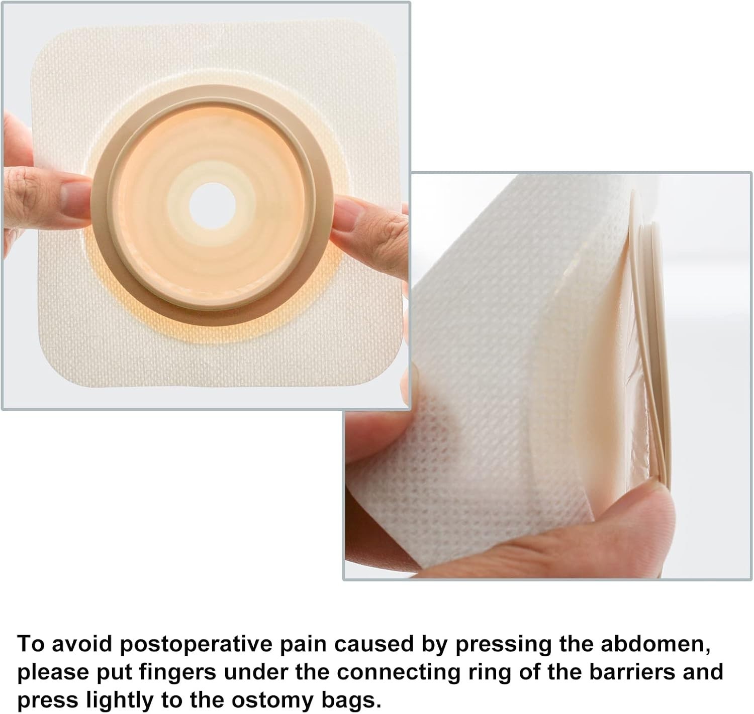 Complete Ostomy Care Set – 21 PCS with Skin-Friendly and Odor Control Features