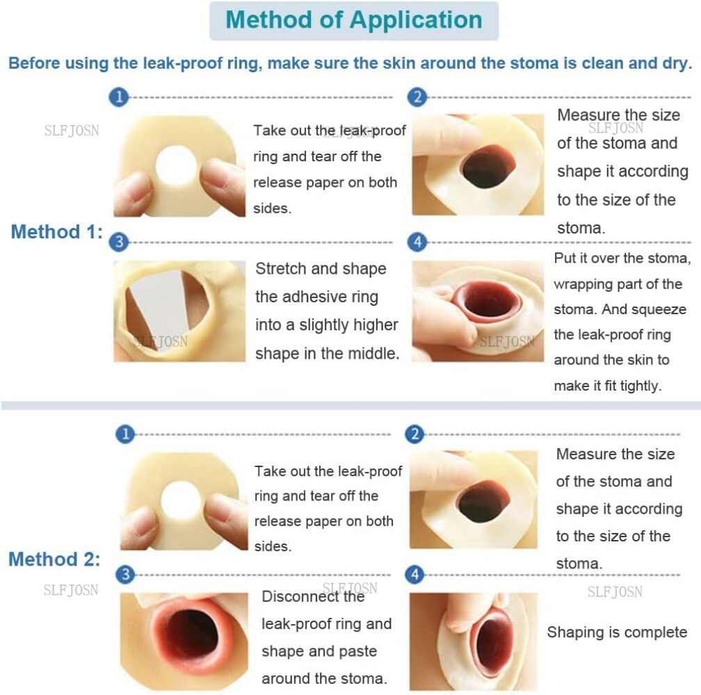 10/20Pack Ostomy Barrier Rings No Leaking Barrier Extenders for Colostomy Bags
