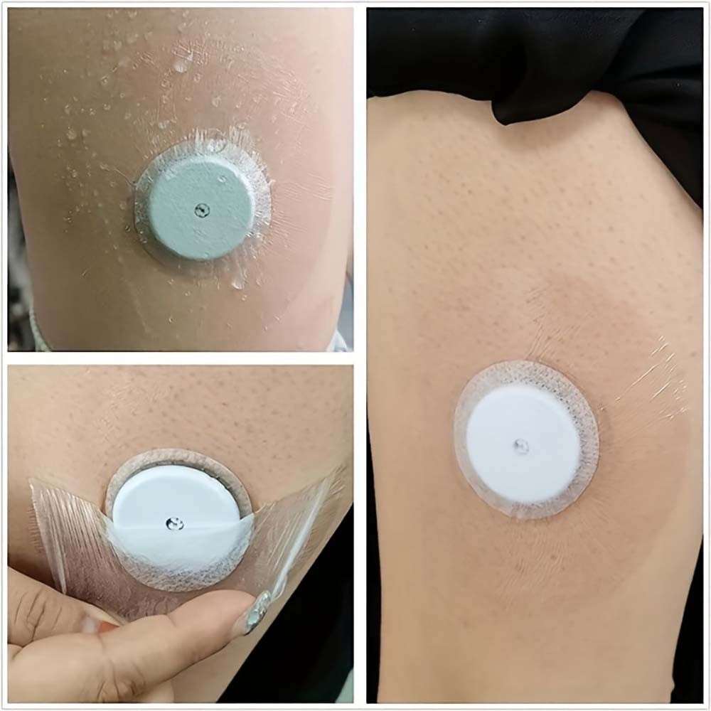 High-Quality Continuous Glucose Monitor Reinforcement Sticker for Daily Use USA