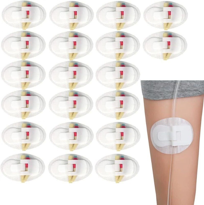 30/50Pcs Urinary Leg Bag Straps Catheter Holder Legband Secure Stabilization