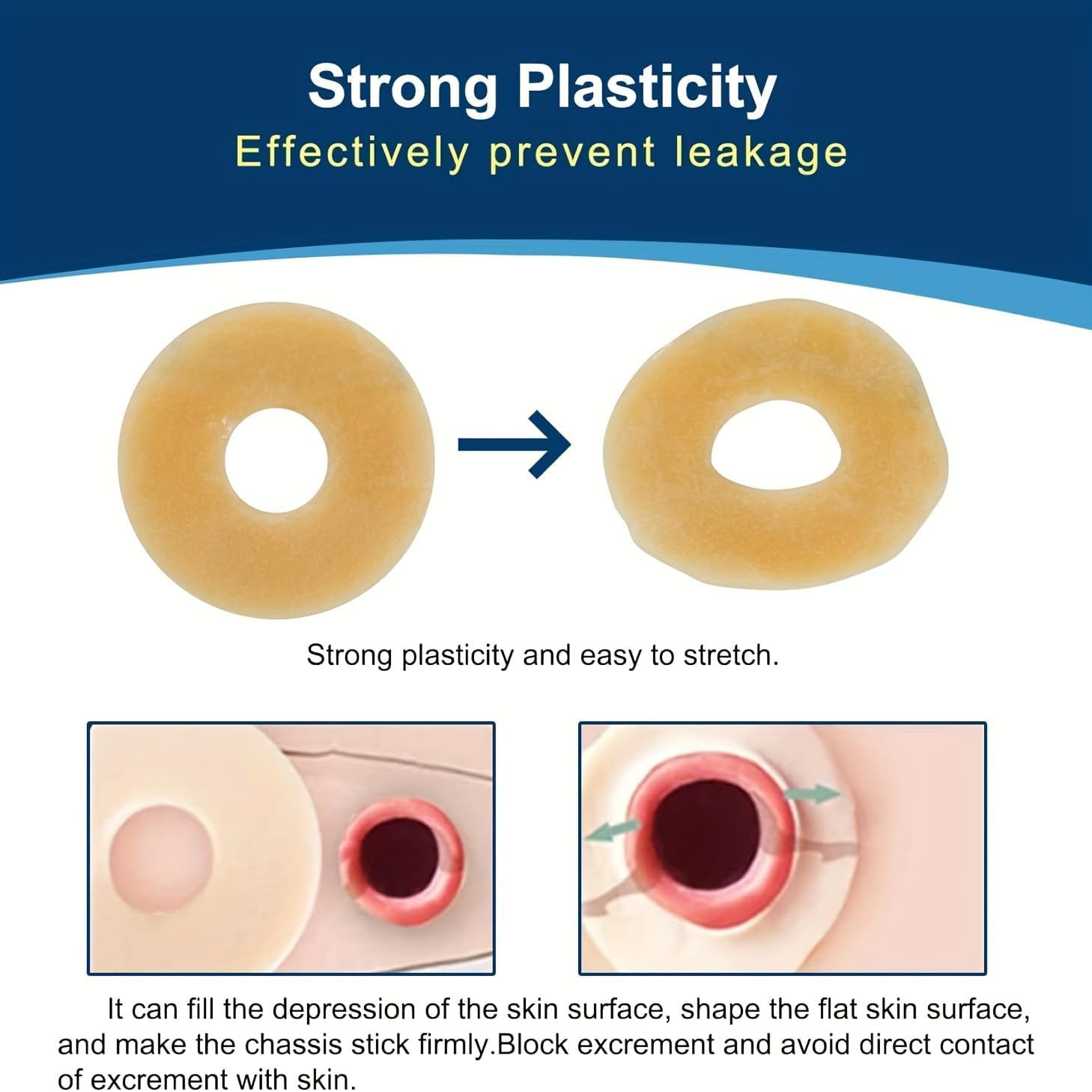 10 PCS Ostomy Barrier Rings, 2Mm Thickness Moldable Colostomy Rings, Medical Gra