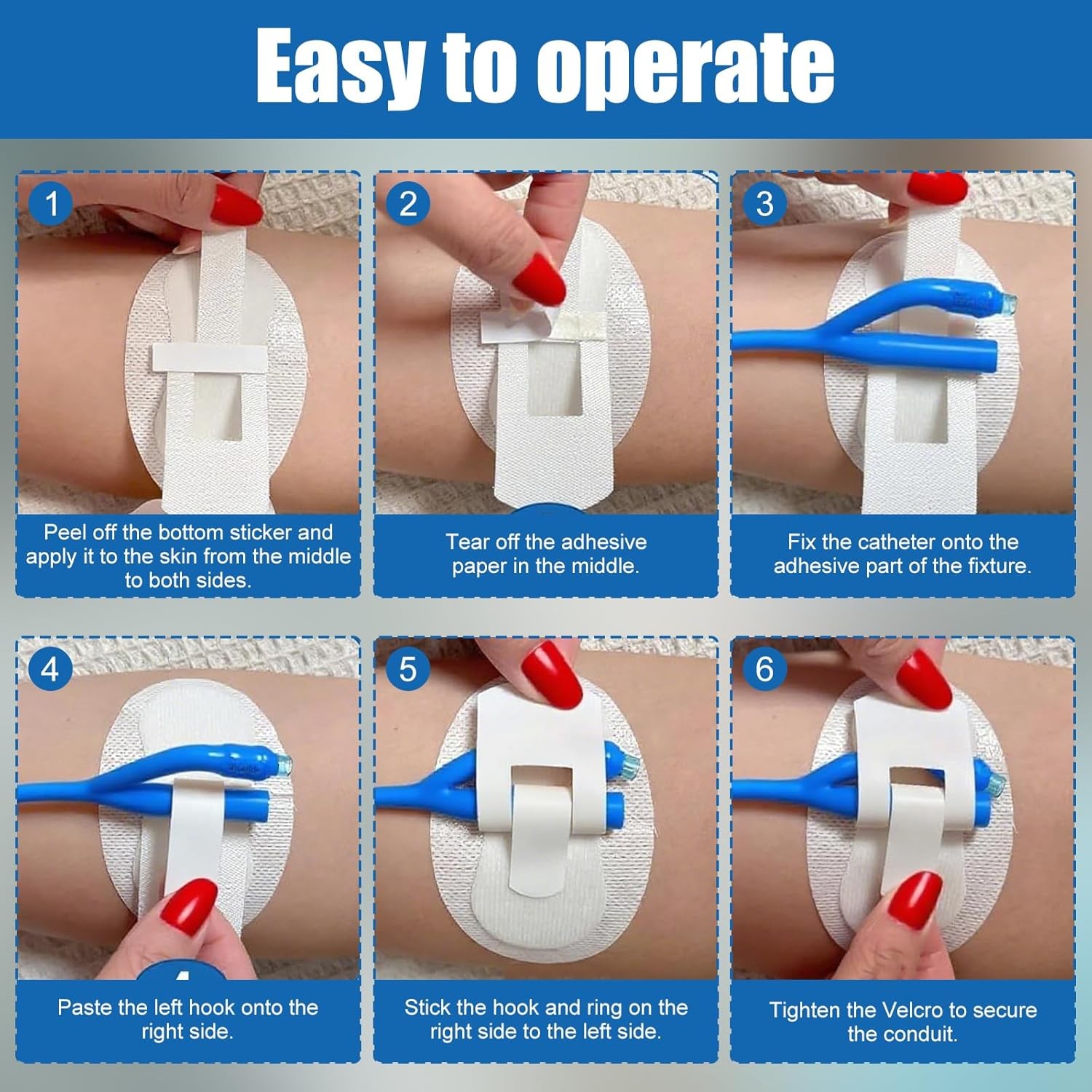 Catheter Stabilization Devices – 8 PCS Self-High Adhesive Catheter Holder, Cathe