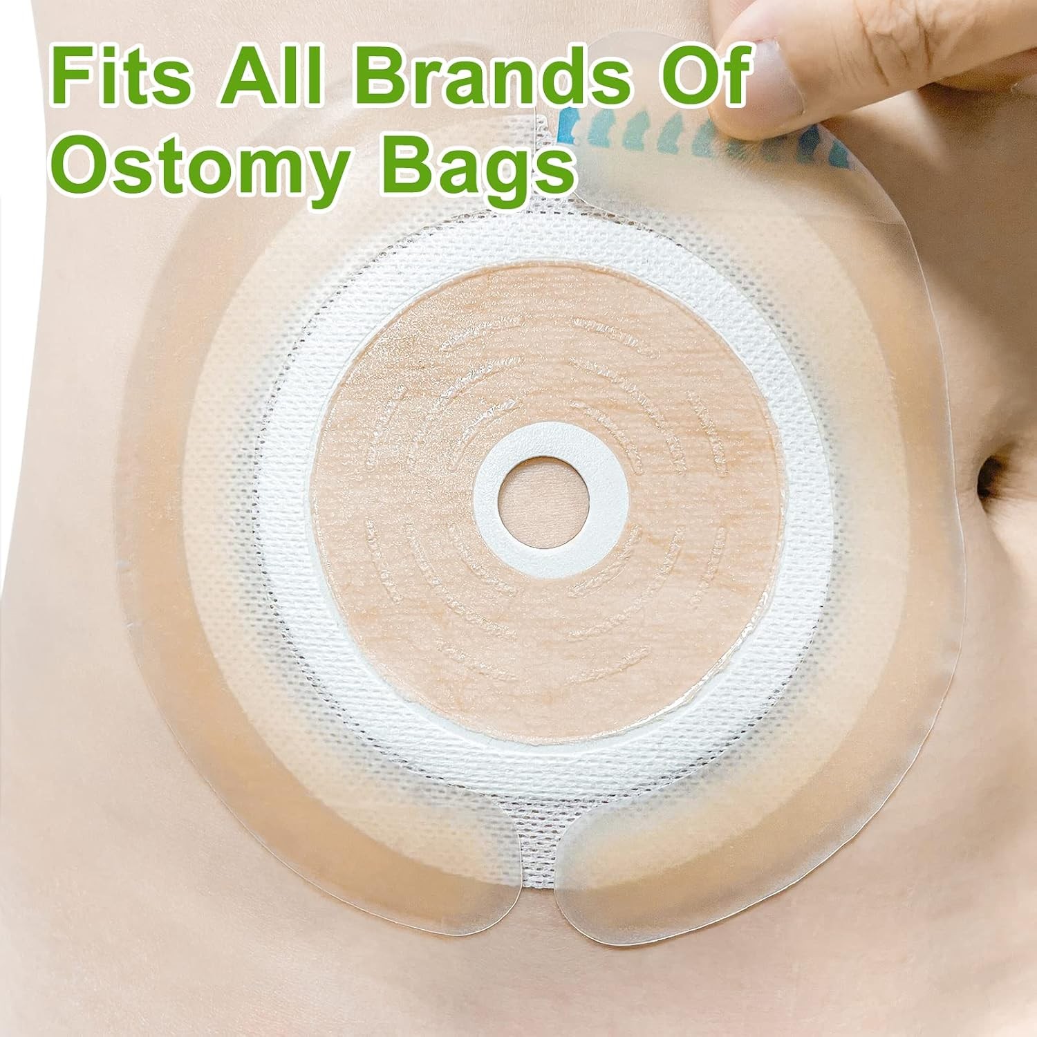 Elastic Ostomy Barrier Strips Hydrocolloid Waterproof Medical Grade 10 Pcs