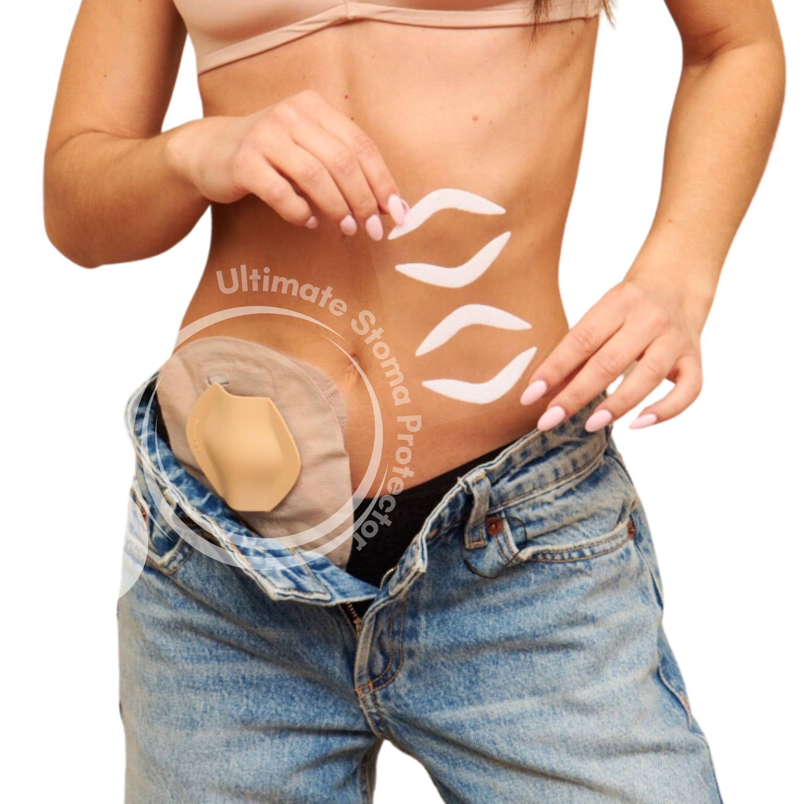 Stoma Guard Shield (Beige) for Ostomy bags | Protect your Colostomy Bags & Il…