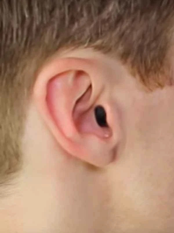 New Pair S igni a Silk 7X Fully Upgraded TRIAL Hearing Device FREE ConnexxAir