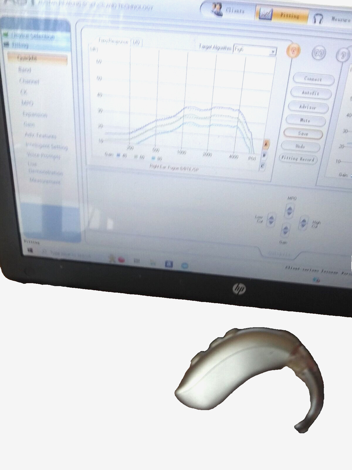 PROGRAMMABLE DIGITAL HEARING AID PROFOUND LOSS . 2 mics 3 programs WE PROGRAM